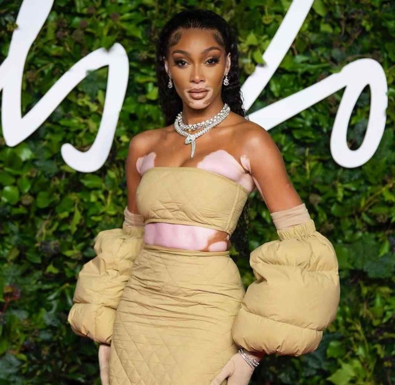 Winnie Harlow Vermögen 2024 Einkommen, Gehälter, Karriere, Bio